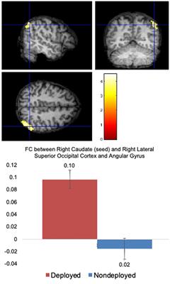 Subcortical functional connectivity and its association with walking performance following deployment related mild TBI